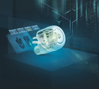 Thumbnail for Siemens makes additive manufacturing capabilities, 3D printers available to medical community